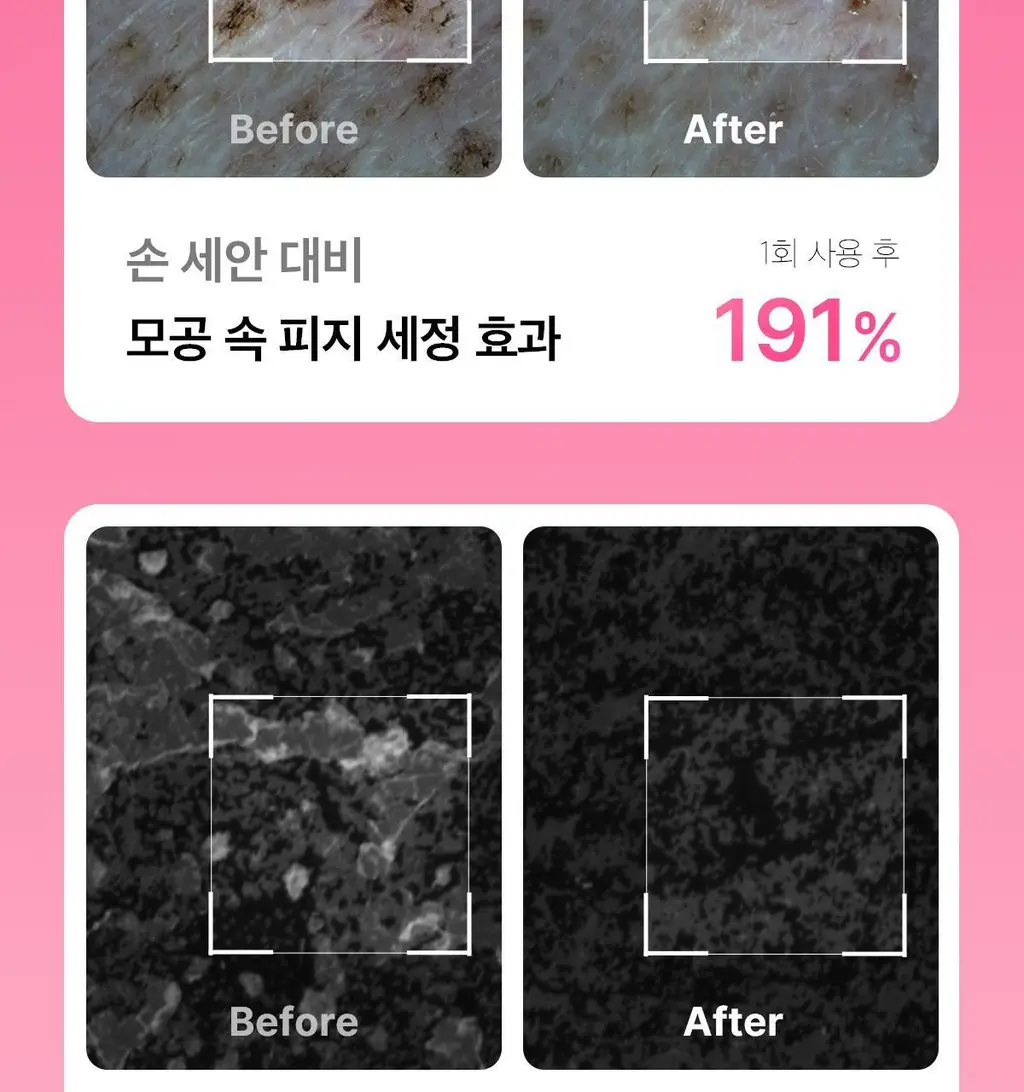 [3D진동클렌징/모공케어] 메디큐브 에이지알 부스터 진동 클렌저 헤드 (베이지/핑크) 상세페이지 25